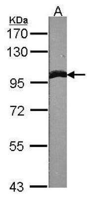 Western Blot: alpha-Actinin 1 Antibody [NBP1-32578]