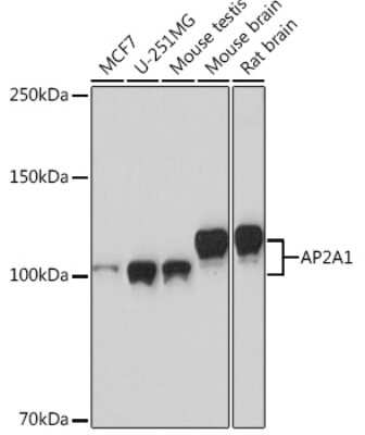 Western Blot: alpha Adaptin Antibody (8R8B6) [NBP3-16402]