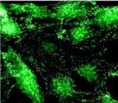 Immunocytochemistry/ Immunofluorescence: alpha Adaptin Antibody (AC1-M11) - BSA Free [NB300-721]