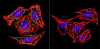 Immunocytochemistry/ Immunofluorescence: alpha Adaptin Antibody (AP6) - BSA Free [NB600-1545]