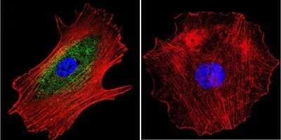 Immunocytochemistry/ Immunofluorescence: alpha Adaptin Antibody (AP6) - BSA Free [NB600-1545]
