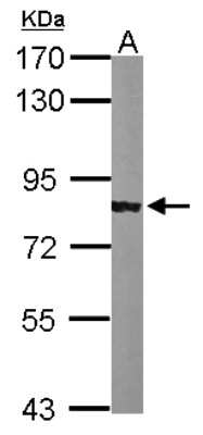 Western Blot: alpha Adducin Antibody [NBP2-15359]