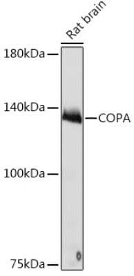 Western Blot: alpha COP I Antibody (3W6Y6) [NBP3-15839]