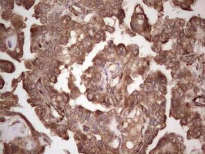 Immunohistochemistry: alpha Desmuslin Antibody (OTI7H6) [NBP2-46044]