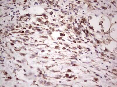 Immunohistochemistry: alpha Desmuslin Antibody (OTI7H6) [NBP2-46044]