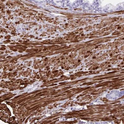 Immunohistochemistry-Paraffin: alpha Desmuslin Antibody [NBP2-37892]