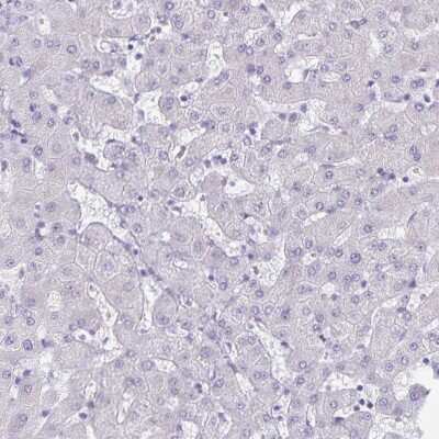 Immunohistochemistry-Paraffin: alpha Desmuslin Antibody [NBP2-37909]