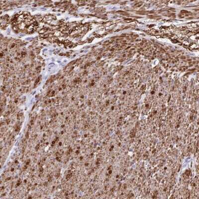 Immunohistochemistry-Paraffin: alpha Desmuslin Antibody [NBP2-37909]