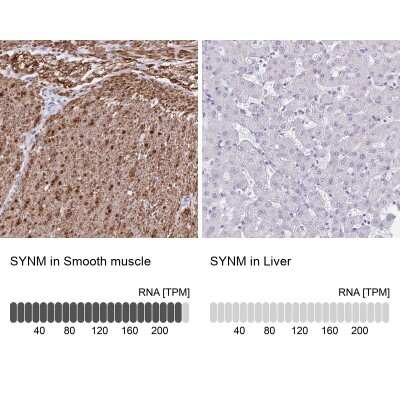 Immunohistochemistry-Paraffin: alpha Desmuslin Antibody [NBP2-37909]