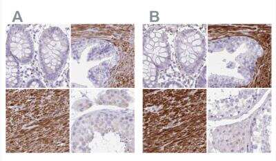 Immunohistochemistry-Paraffin: alpha Desmuslin Antibody [NBP2-37909]