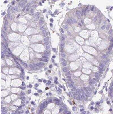Immunohistochemistry-Paraffin: alpha Desmuslin Antibody [NBP2-37909]