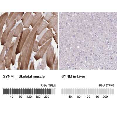 Immunohistochemistry-Paraffin: alpha Desmuslin Antibody [NBP2-37909]