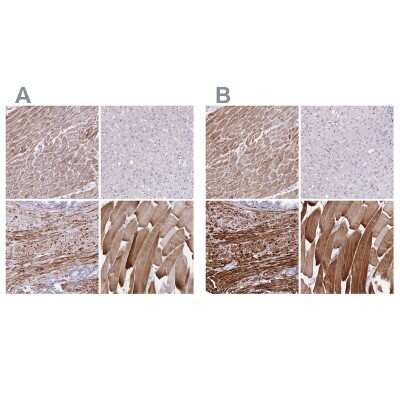 Immunohistochemistry-Paraffin: alpha Desmuslin Antibody [NBP2-37909]