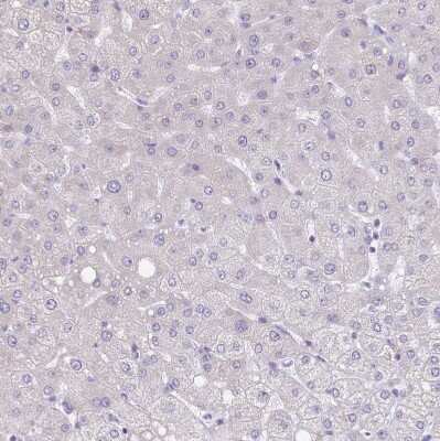 Immunohistochemistry-Paraffin: alpha Desmuslin Antibody [NBP2-37909]