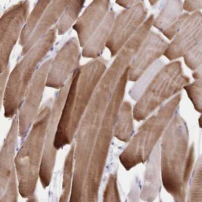 Immunohistochemistry-Paraffin: alpha Desmuslin Antibody [NBP2-37909]