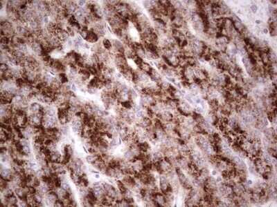 Immunohistochemistry: alpha Desmuslin Antibody (OTI7H6) - Azide and BSA Free [NBP2-71736]