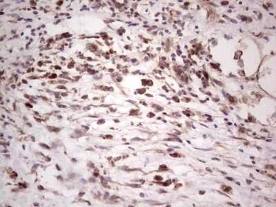 Immunohistochemistry: alpha Desmuslin Antibody (OTI7H6) - Azide and BSA Free [NBP2-71736]