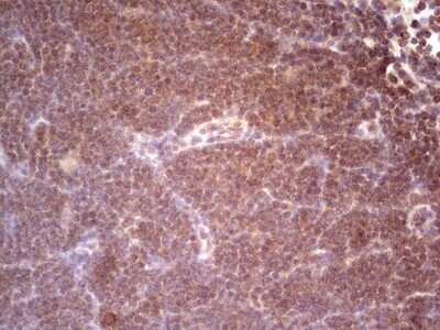 Immunohistochemistry: alpha Desmuslin Antibody (OTI7H6) - Azide and BSA Free [NBP2-71736]