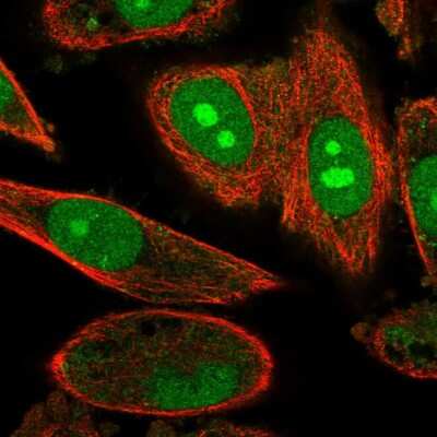 Immunocytochemistry/ Immunofluorescence: alpha Endosulfine Antibody [NBP2-13963]