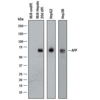 Western Blot: alpha-Fetoprotein/AFP Antibody (189508) [MAB13692]