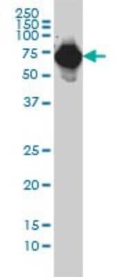 Western Blot: alpha-Fetoprotein/AFP Antibody (1G7) [H00000174-M01]
