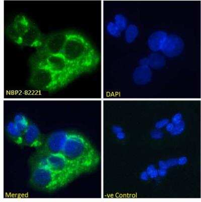 Immunocytochemistry/ Immunofluorescence: alpha-Fetoprotein/AFP Antibody (AF5) - Chimeric - Azide and BSA Free [NBP2-82221]