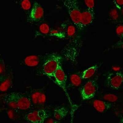 Immunocytochemistry/ Immunofluorescence: alpha-Fetoprotein/AFP Antibody (C2 + C3 + MBS-12) - Azide and BSA Free [NBP2-48013]