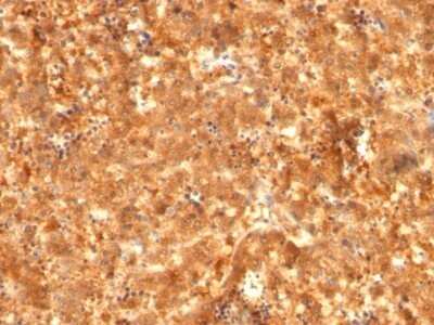 Immunohistochemistry-Paraffin: alpha-Fetoprotein/AFP Antibody (C2 + C3 + MBS-12) - IHC-Prediluted [NBP2-48111]