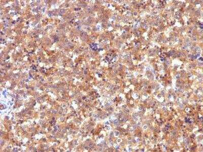 Immunohistochemistry-Paraffin: alpha-Fetoprotein/AFP Antibody (C2) - IHC-Prediluted [NBP2-48121]