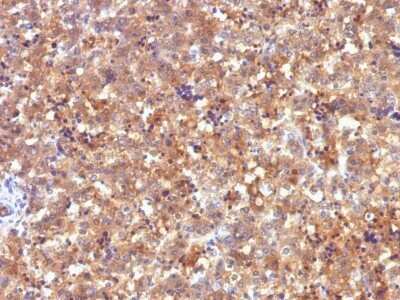 Immunohistochemistry-Paraffin: alpha-Fetoprotein/AFP Antibody (C2) [NBP2-45014]