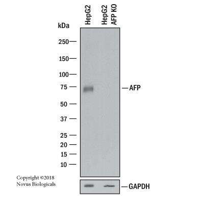 Western Blot: alpha-Fetoprotein/AFP Antibody (C3) [NBP2-32914]