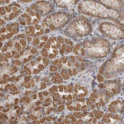 Immunohistochemistry: alpha-Fetoprotein/AFP Antibody [NBP2-80483]