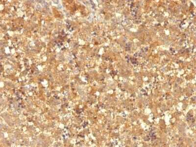 Immunohistochemistry-Paraffin: alpha-Fetoprotein/AFP Antibody (MBS-12) - Azide and BSA Free [NBP2-48015]