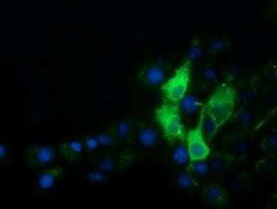Immunocytochemistry/ Immunofluorescence: alpha-Fetoprotein/AFP Antibody (OTI2A9) [NBP2-03084]