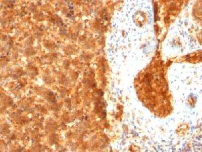 Immunohistochemistry-Paraffin: alpha-Fetoprotein/AFP Antibody (SPM334) [NBP2-32915]