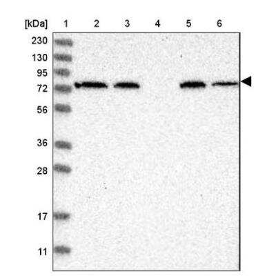 Western Blot: alpha-Fetoprotein/AFP Antibody [NBP2-80483]