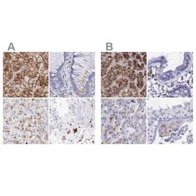 Immunohistochemistry-Paraffin: alpha-Galactosidase A/GLA Antibody [NBP1-89796]