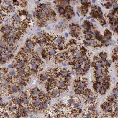 Immunohistochemistry-Paraffin: alpha-Galactosidase A/GLA Antibody [NBP1-89797]