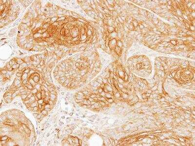 Immunohistochemistry-Paraffin: alpha-Galactosidase A/GLA Antibody [NBP2-16576]