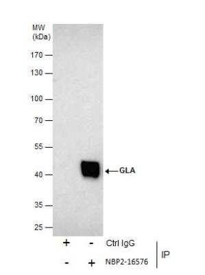 Immunoprecipitation: alpha-Galactosidase A/GLA Antibody [NBP2-16576]
