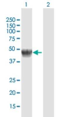 Western Blot: alpha-Galactosidase A/GLA Antibody [H00002717-D01P]