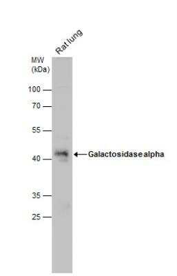 Western Blot: alpha-Galactosidase A/GLA Antibody [NBP2-16576]