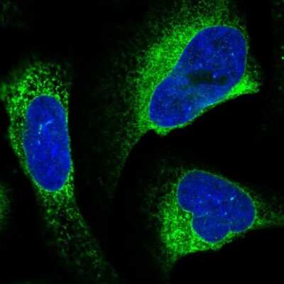Immunocytochemistry/ Immunofluorescence: alpha Glucosidase 2 Antibody [NBP2-49332]