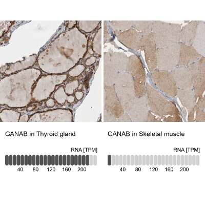Immunohistochemistry-Paraffin: alpha Glucosidase 2 Antibody [NBP1-89806]