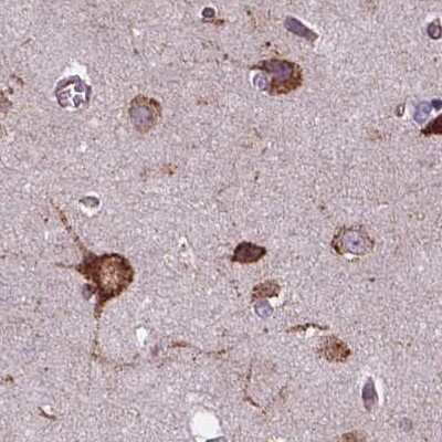 Immunohistochemistry-Paraffin: alpha Glucosidase 2 Antibody [NBP2-49332]