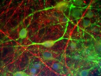 Immunocytochemistry/ Immunofluorescence: alpha-Internexin Antibody (1D2) [NB300-216]