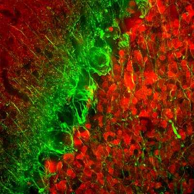Immunohistochemistry Free-Floating: alpha-Internexin Antibody (1D2) [NB300-216]