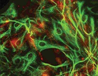 Immunocytochemistry/ Immunofluorescence: alpha-Internexin Antibody (2E3) [NB300-140]