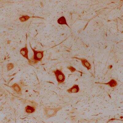 Immunohistochemistry: alpha-Internexin Antibody (2E3) [NB300-140]