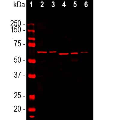 Western Blot: alpha-Internexin Antibody (2E3) [NB300-140]